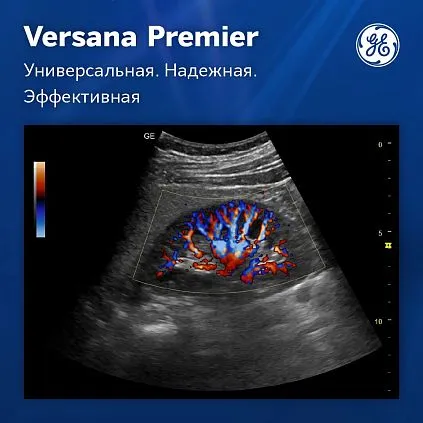 Клинические изображения Ультразвуковая система GE Versana Premier Black