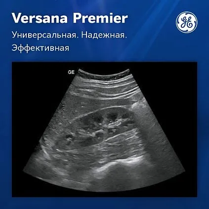 Клинические изображения Ультразвуковая система GE Versana Premier Black